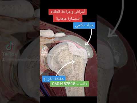 طبيب اختصاصي أمراض و جراحة العظام و المفاصل بالمغرب الرباط مكناس