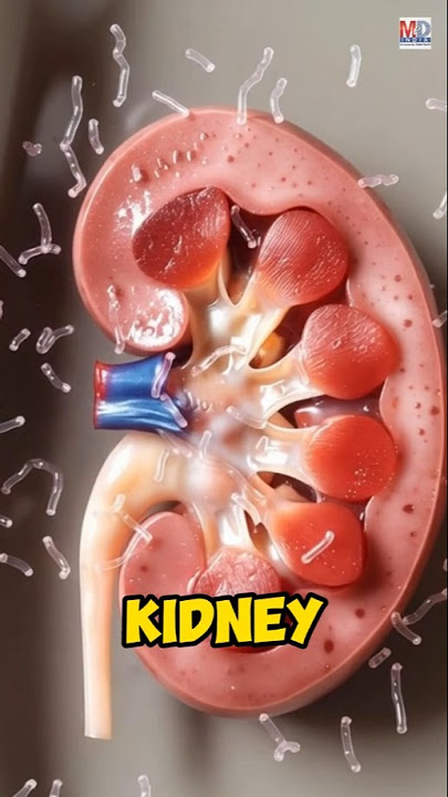 cfDNA: The Early Warning Saving Your New Kidney! 🚨 #trending #ytshorts #kidneyhealth #kidney
