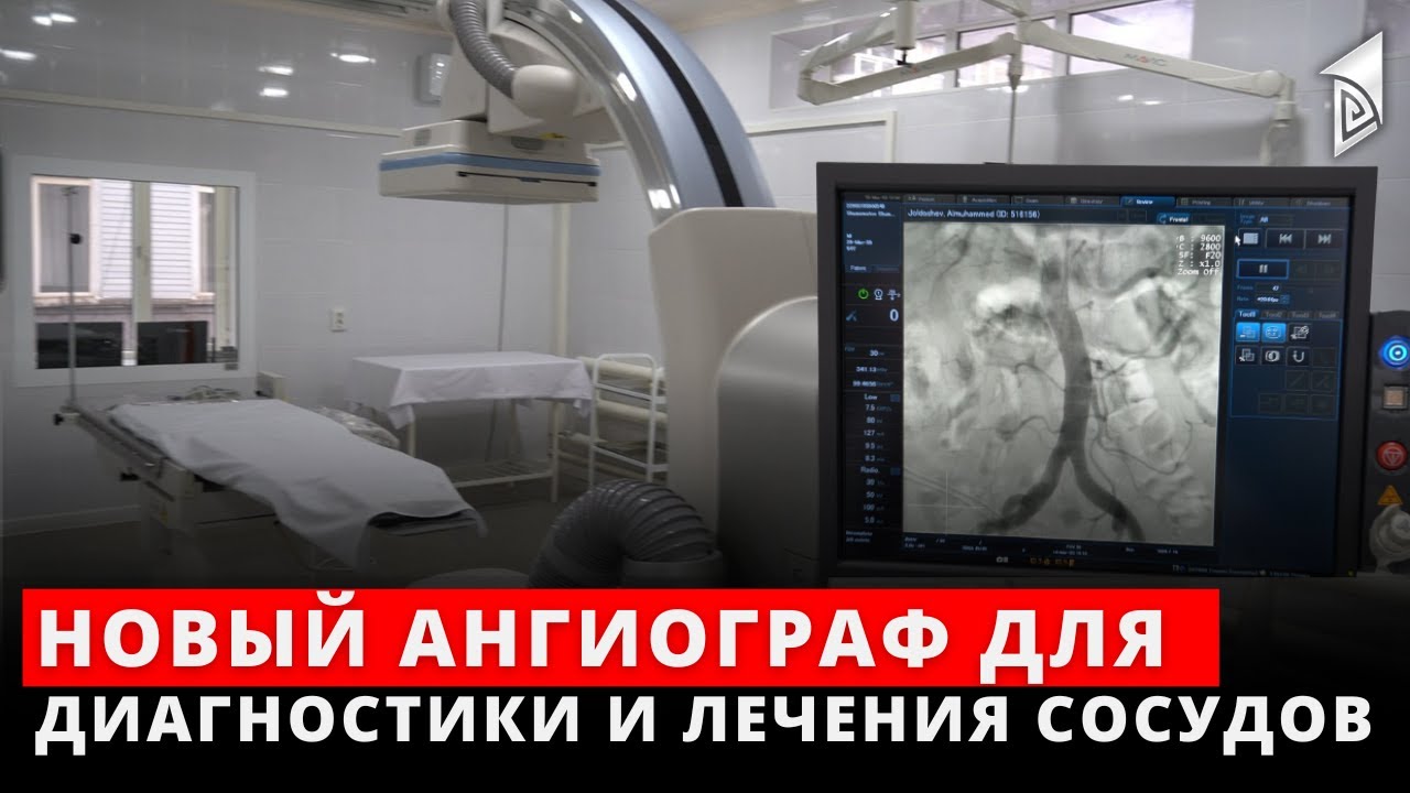 Новый ангиограф для диагностики и лечения сосудов - YouTube