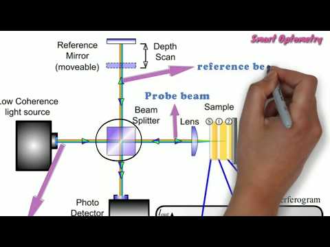 Optical Coherence Tomography - OCT (Full)