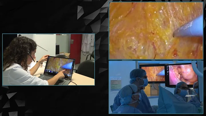 Telestration in Minimally Invasive Surgery - DayDayNews