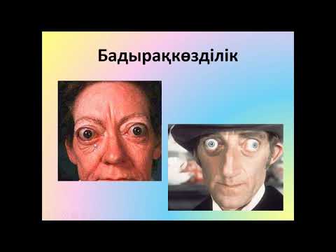 Бейне: Гексокиназа ферментінің активаторы қайсысы?