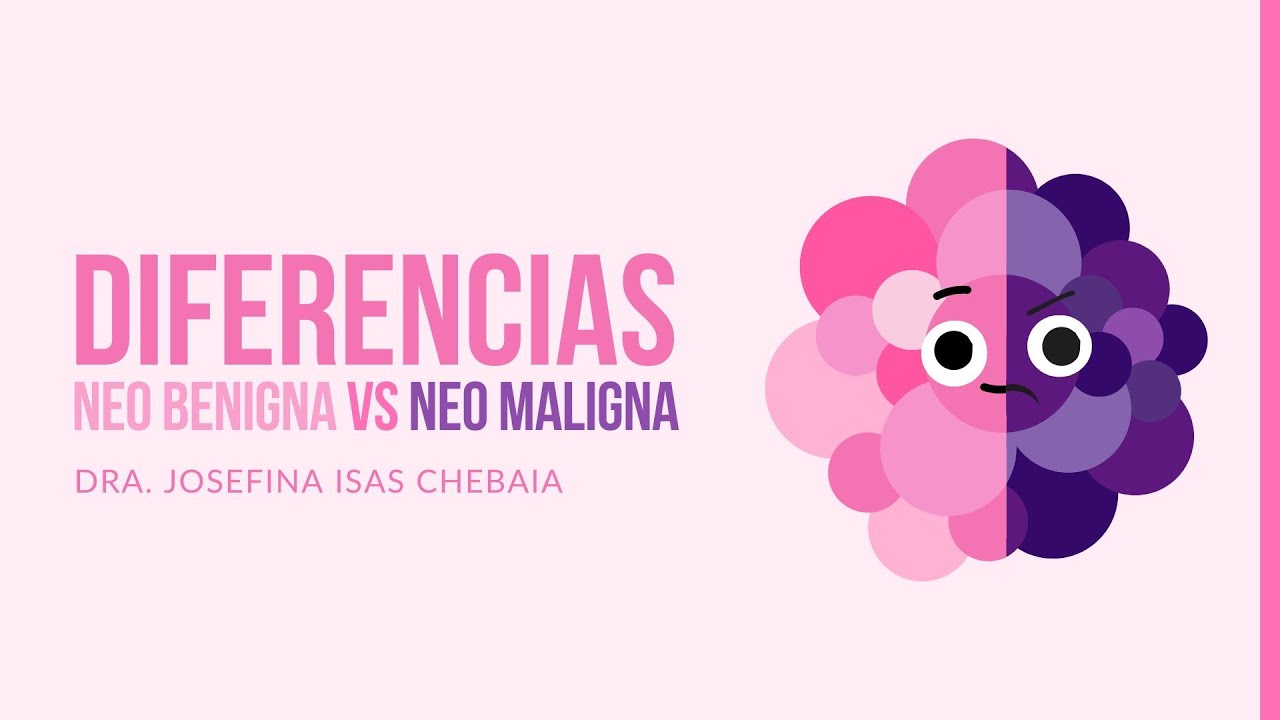Diferencias de neoplasias benignas y malignas