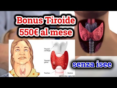 Bonus Tiroide 550€. cos'e.come fare domanda.hindi urdu.