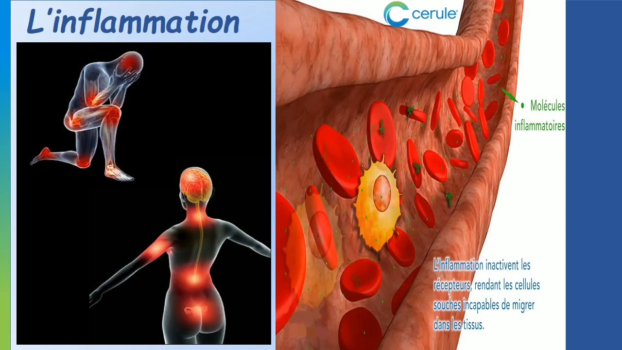 Quest Ce Quune Inflammation 🌿🌾 Youtube