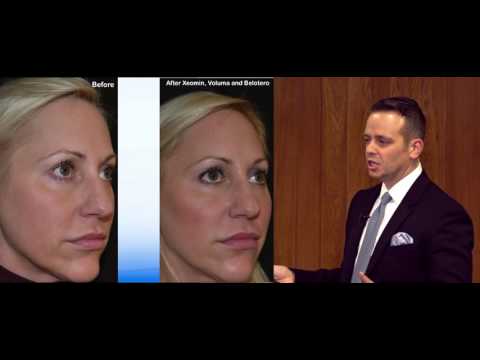 Video: Hvor Lenge Varer Fyllstoff For Juvederm, Restylane, More