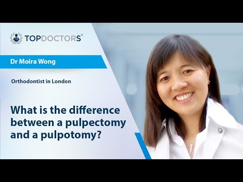 Video: Hoe lang duurt een pulpectomie?