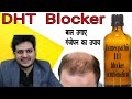 Homeopathic DHT blocker Combination | ganjapan | alopecia | hair fall |