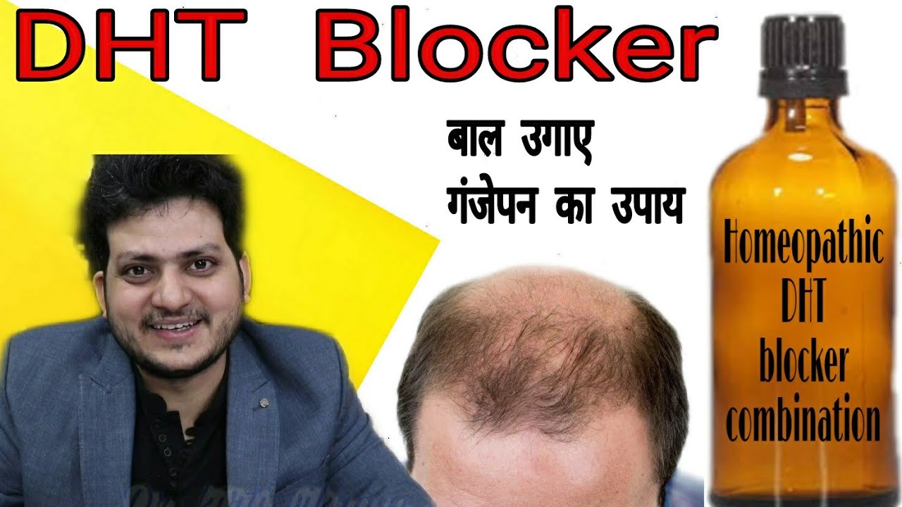 Homeopathic Dht Blocker Combination Ganjapan Alopecia Hair Fall Youtube