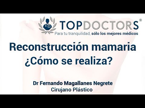 Cirugía de reconstrucción mamaria post mastectomía -  Dr. Fernando Magallanes Negrete