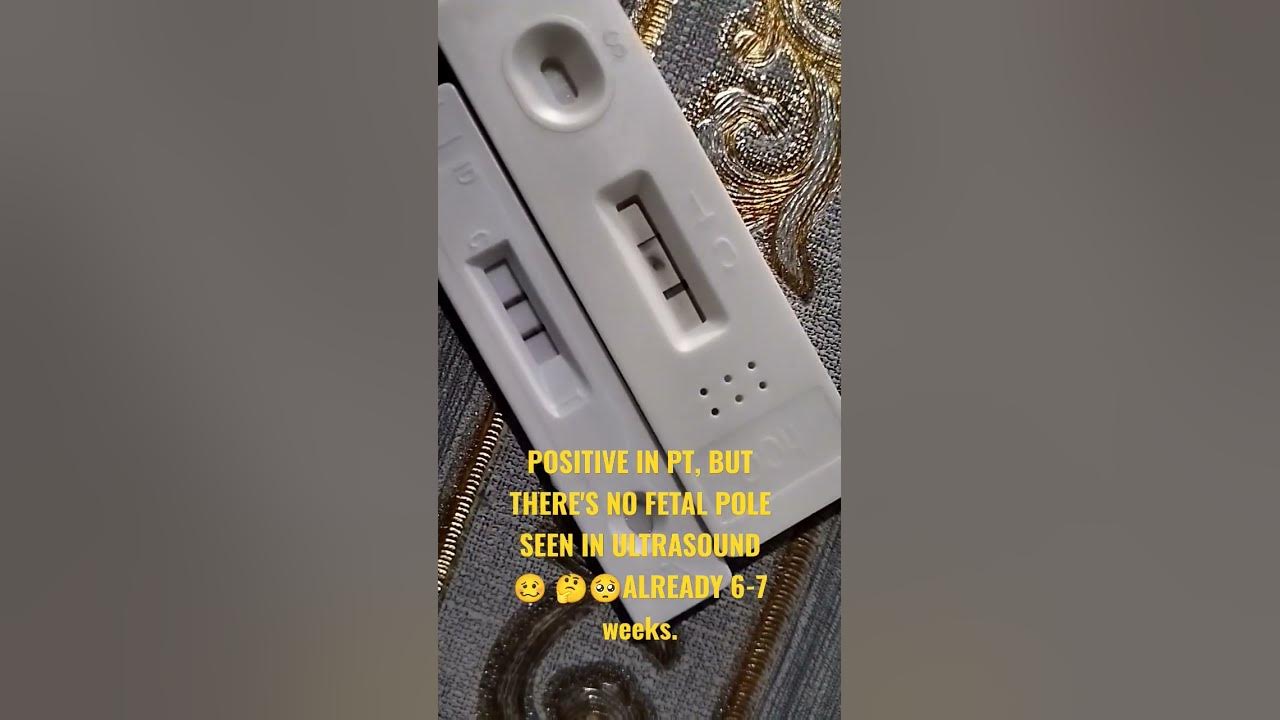 already-6-7weeks-preggy-but-no-fetal-pole-seen-in-ultrasound-fyp
