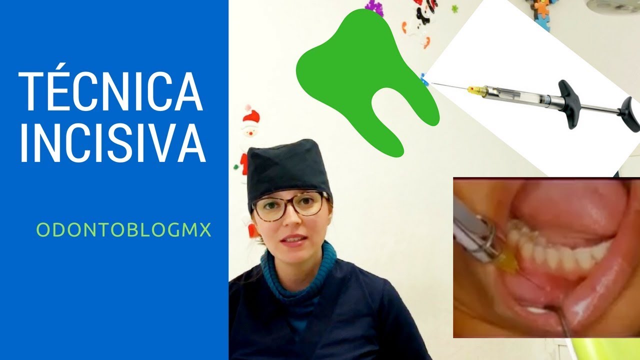 Técnica de anestesia Incisiva