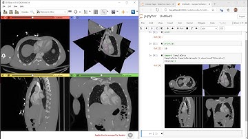 Use 3D Slicer from Jupyter notebook (installation)