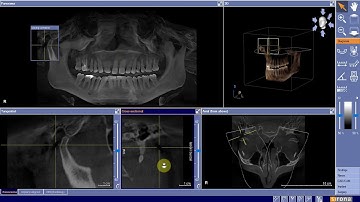 CBCT Basic Image Planes