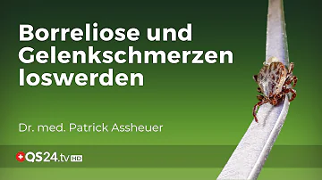 Welche Gelenke Schmerzen bei Borreliose?