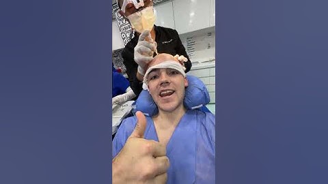 ME OPERÉ y ahora soy CALVO?! 😳🥵😭🫣😱