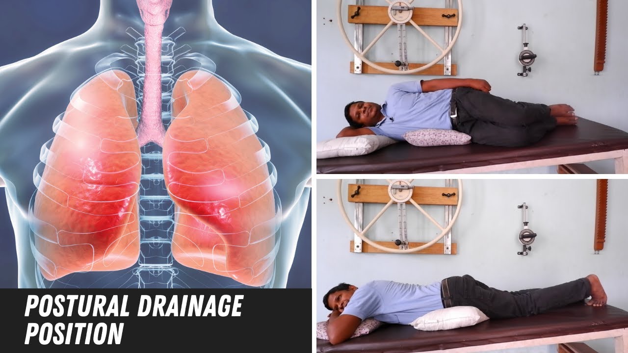 Postural Drainage Position, Take out Cough from Chest| बलगम निकालने की एक्सर्साइज़