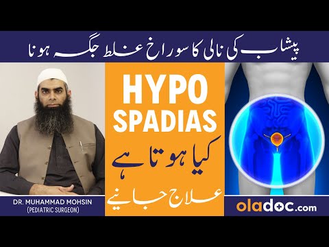 Bachon Me Pishab Ki Nali Ka Tedhapan - Hypospadias Ki Wajah Aur Ilaj - Hypospadias Treatment & Care thumbnail image