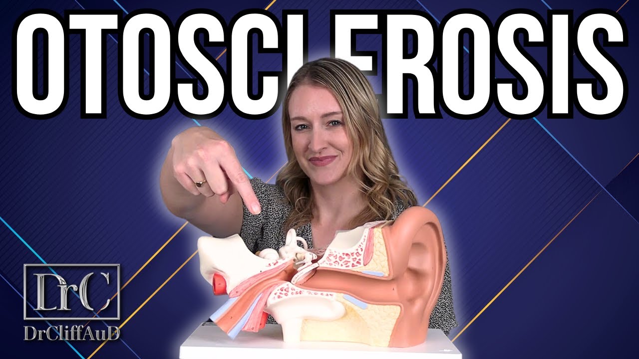 У вас отосклероз? | Диагностика и варианты лечения