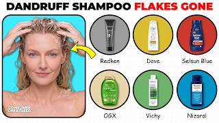 10 BEST ANTI-DANDRUFF SHAMPOOS That ELIMINATE FLAKES in ONE WEEK
