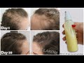 30 Days Summer Hair Growth Challenge,🌿Regrow Lost Hair, Get Double Density and Thick Hair
