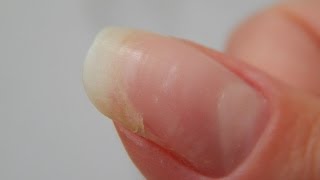 видео Восстановление собственный ногтей после наращивания.
