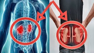 ОПУЩЕНИЕ ПОЧКИ. Ряд ДЕЙСТВИЙ, которые ПОМОГУТ избежать УСУГУБЛЕНИЯ Опущения Почки. ОПУЩЕНИЕ ПОЧКИ. Ряд ДЕЙСТВИЙ, которые ПОМОГУТ избежать УСУГУБЛЕНИЯ Опущения Почки.