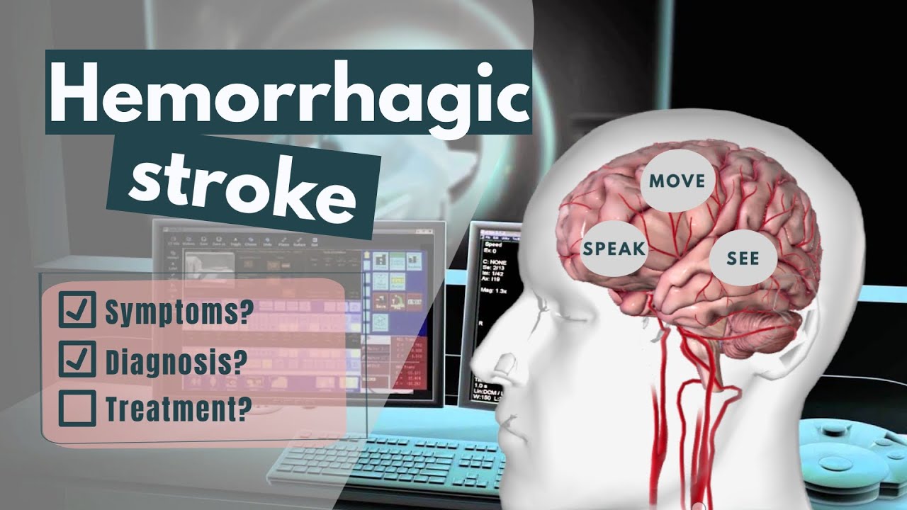 ⁣Hemorrhagic stroke | Symptoms, diagnosis, treatment, complications & risk factors