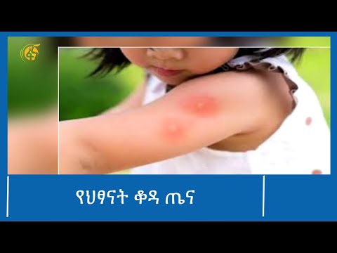 ቪዲዮ: የጨቅላ ህመም ይጠፋል?