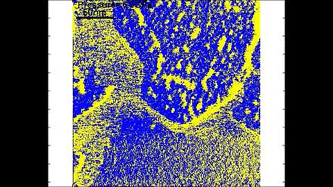 Pressure-Induced Melting of Confined Ice