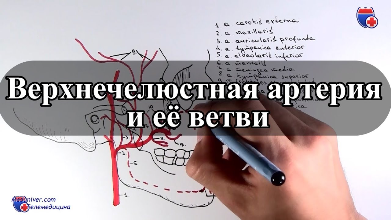 Стентирование сонных артерий как метод эндоваскулярной операции для профилактики инсульта (анимация)