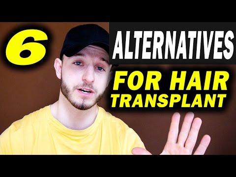 6 Hair Transplant Alternatives + Before After Results