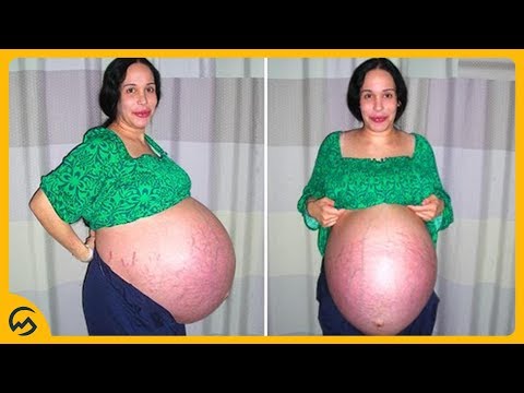 Video: 30 Zwangerschapsfeiten Die U Kunnen Verrassen, Plus 5 Mythen