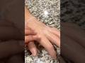 Satisfying Wax Peel #asmr