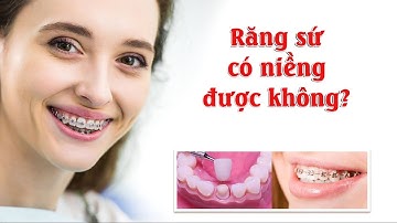 Răng sứ có niềng được không? | Phương pháp niềng răng nào tốt nhất hiện nay? | Nha Khoa Uy Tín