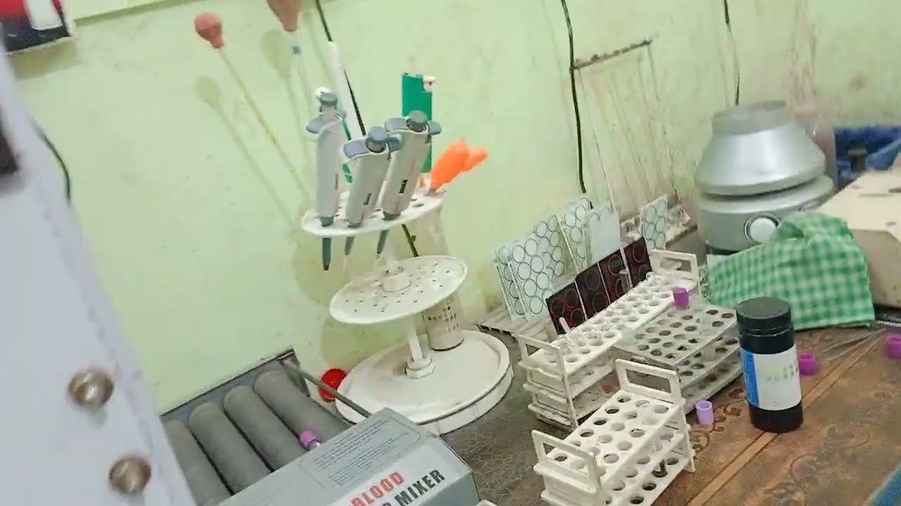 C B C जांच कैसे होता हैं #cbc #sugar #labtechnician #hospital #bloodtest #blood #viralvideo #vlog 