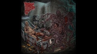 Insidious Squelching Penetration - Writhing in Darkness 2018 Full Album