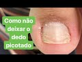 COMO NÃO DEIXAR AS UNHAS PICOTADAS.Dicas para um acabamento perfeito