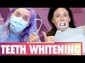 Does Professional Teeth Whitening WORK?! (Beauty Trippin)