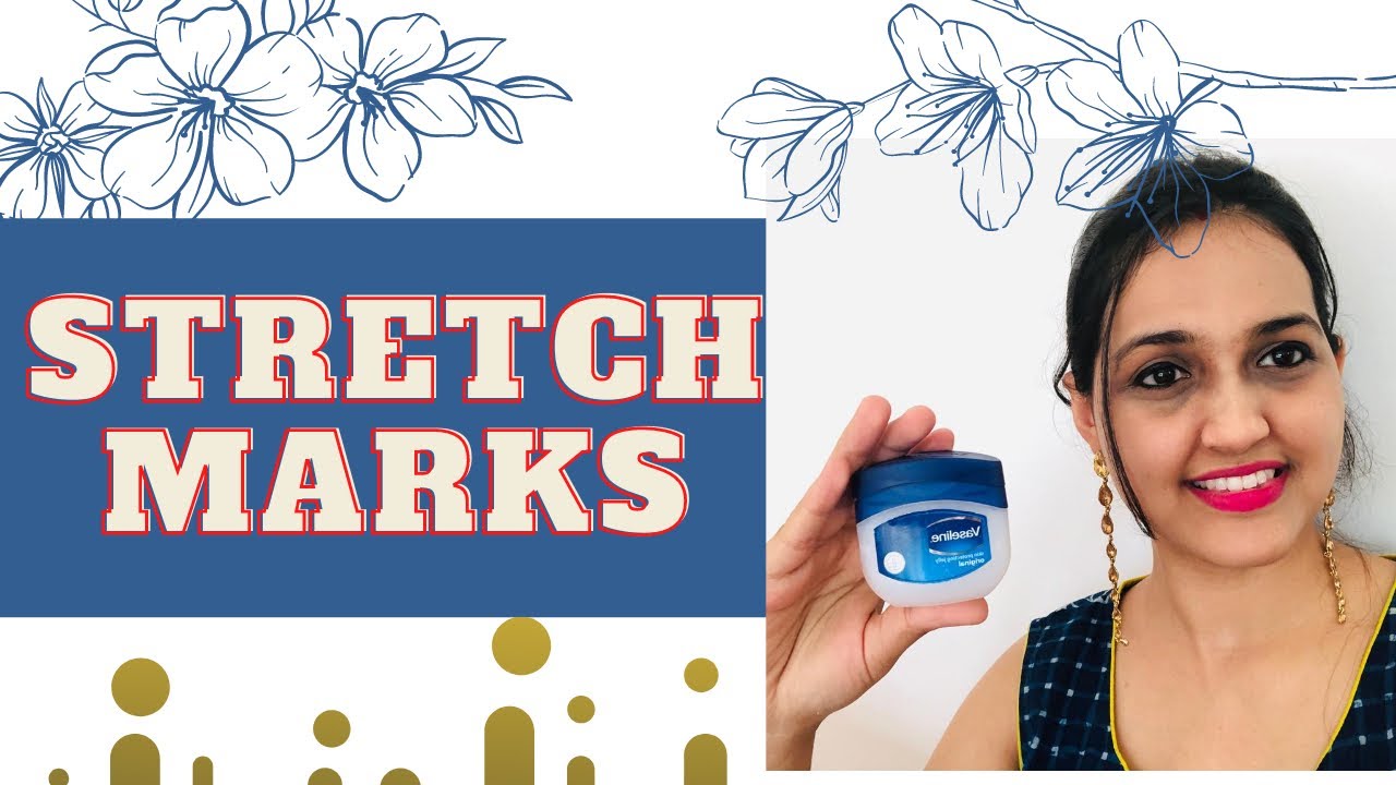 How to reduce stretch marks after pregnancy use of Vaseline YouTube