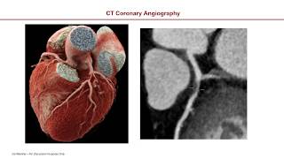 Cardiac Gating Editiing Techniques screenshot 4