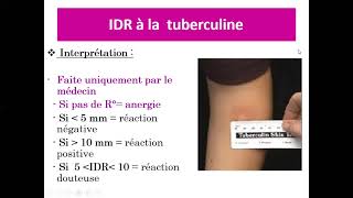 04.05.Primo-infection tuberculeuse - Tuberculose Pulmonaire commune Pr Yahaoui) (Beni Messousse)