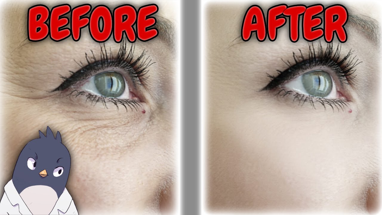 Is Astaxanthin Good For Wrinkles & Sun Protection? YouTube