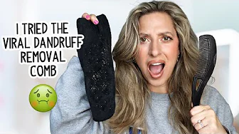 I TRIED THE VIRAL DANDRUFF REMOVAL COMB- DOES IT ACTUALLY WORK?