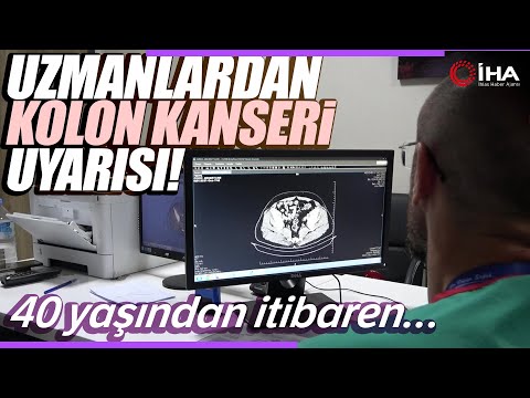 Kolon Kanserinin İlk Belirtileri Nelerdir, Kolon Kanseri Nasıl Başlar?