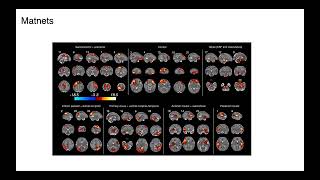 OHBM 2023 | 2783 | Symposium | Vyacheslav Karolis | Emerging patterns of functional connectivity i…