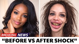 15 Celebrities Before and After Plastic Surgery