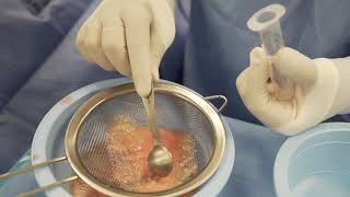 Penis Enlargement Surgery