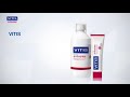 Vitis anticaries  erosin dental