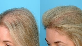 видео Маска для волос